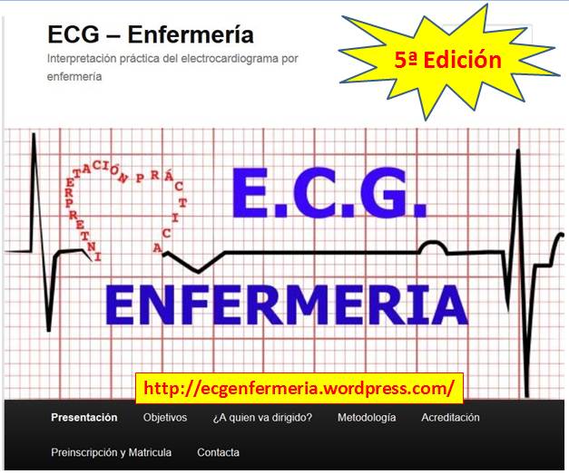 ECG5Edicion.jpg