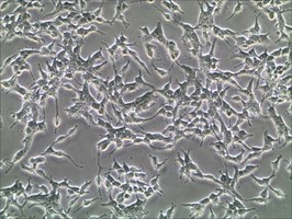 Foto de un cultivo de células tumorales  pancreáticas AR42J